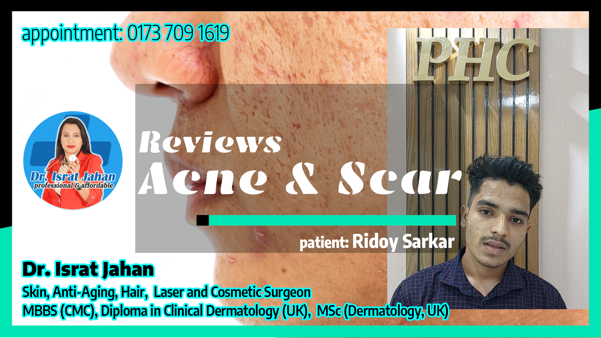 Acne & Scar Reviews Ridoy Sarkar - ব্রণের জন‍্য পাওয়ারফুল এক্ নি প‍্যাকেজ