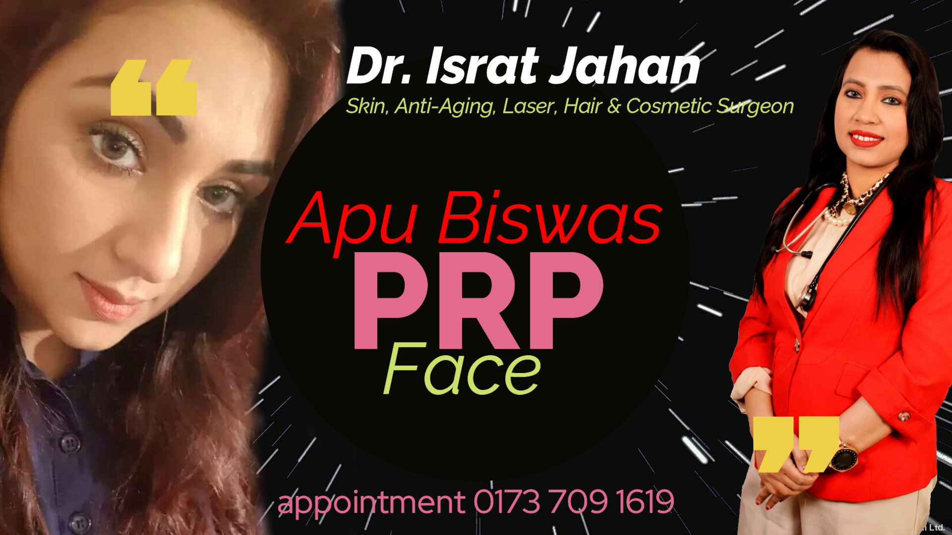 PRP or Baby Face therapy is a miracle treatment - Apu Biswas - Dr. Israt Jahan