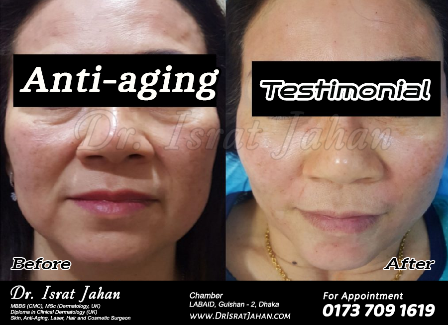 Look 10 years younger in 30 min!