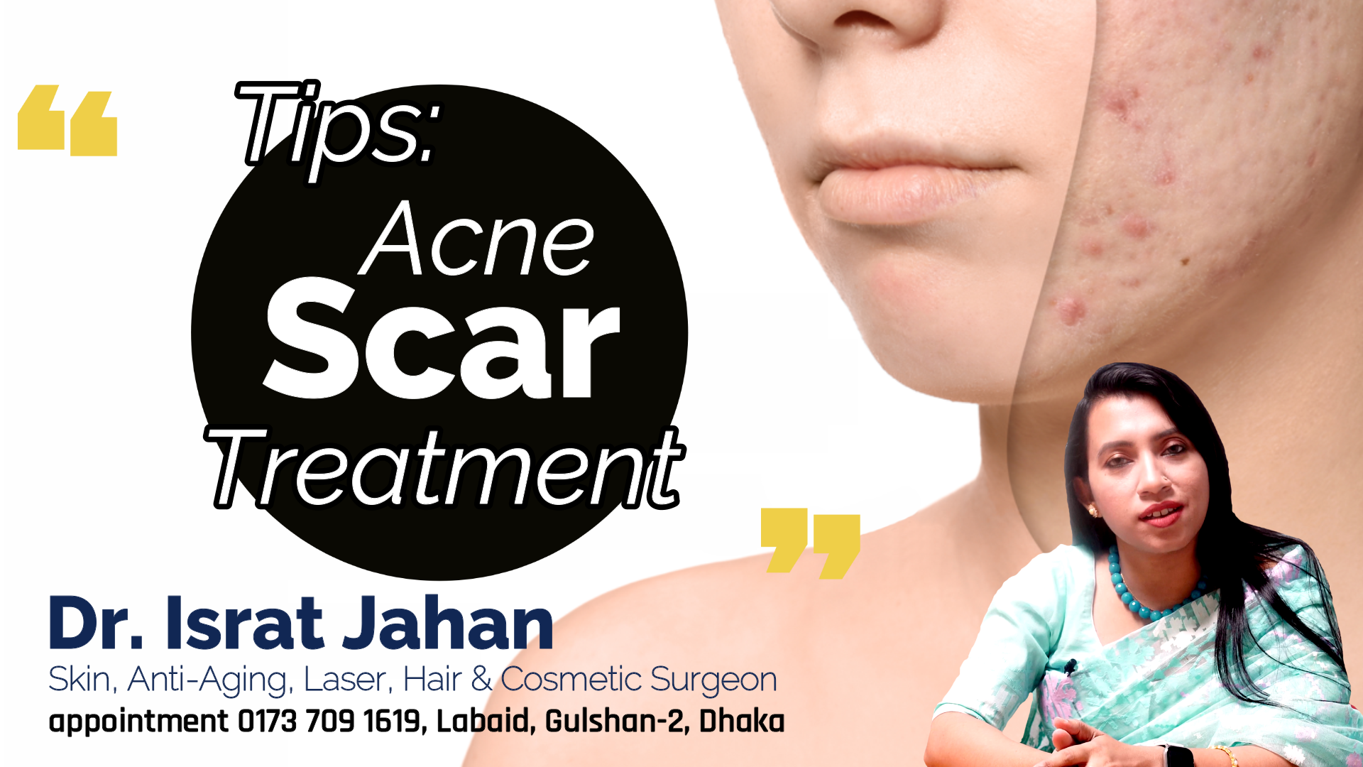ব্রণ ও ব্রণের গর্ত কী আপনার সমস‍্যা? - Acne Scar Tips - Dr. Israt Jahan