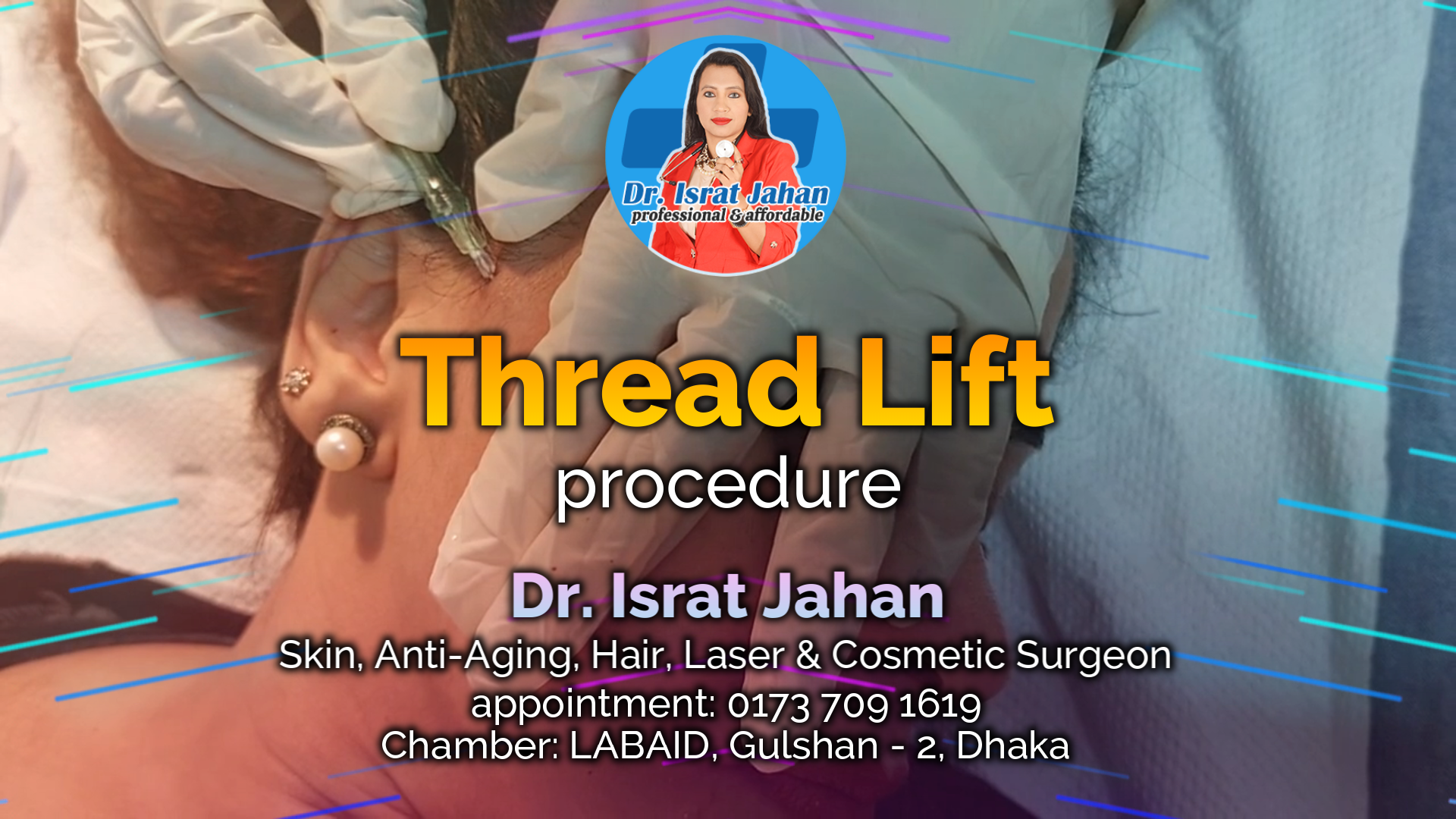 Thread Lift Procedure আপনি কী ত্রিশ মিনিটের মধ‍্যে আপনার ঝুলে যাওয়া মুখ ঠিক করতে চান??