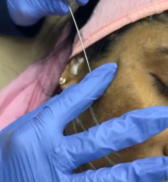 Face shaping