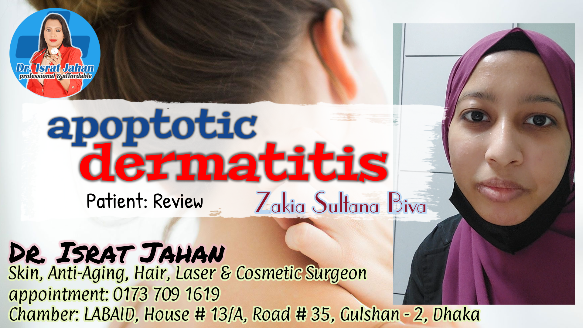 Atopic dermatitis (eczema) is a condition that makes your skin red & itchy Review - Dr. Israt Jahan