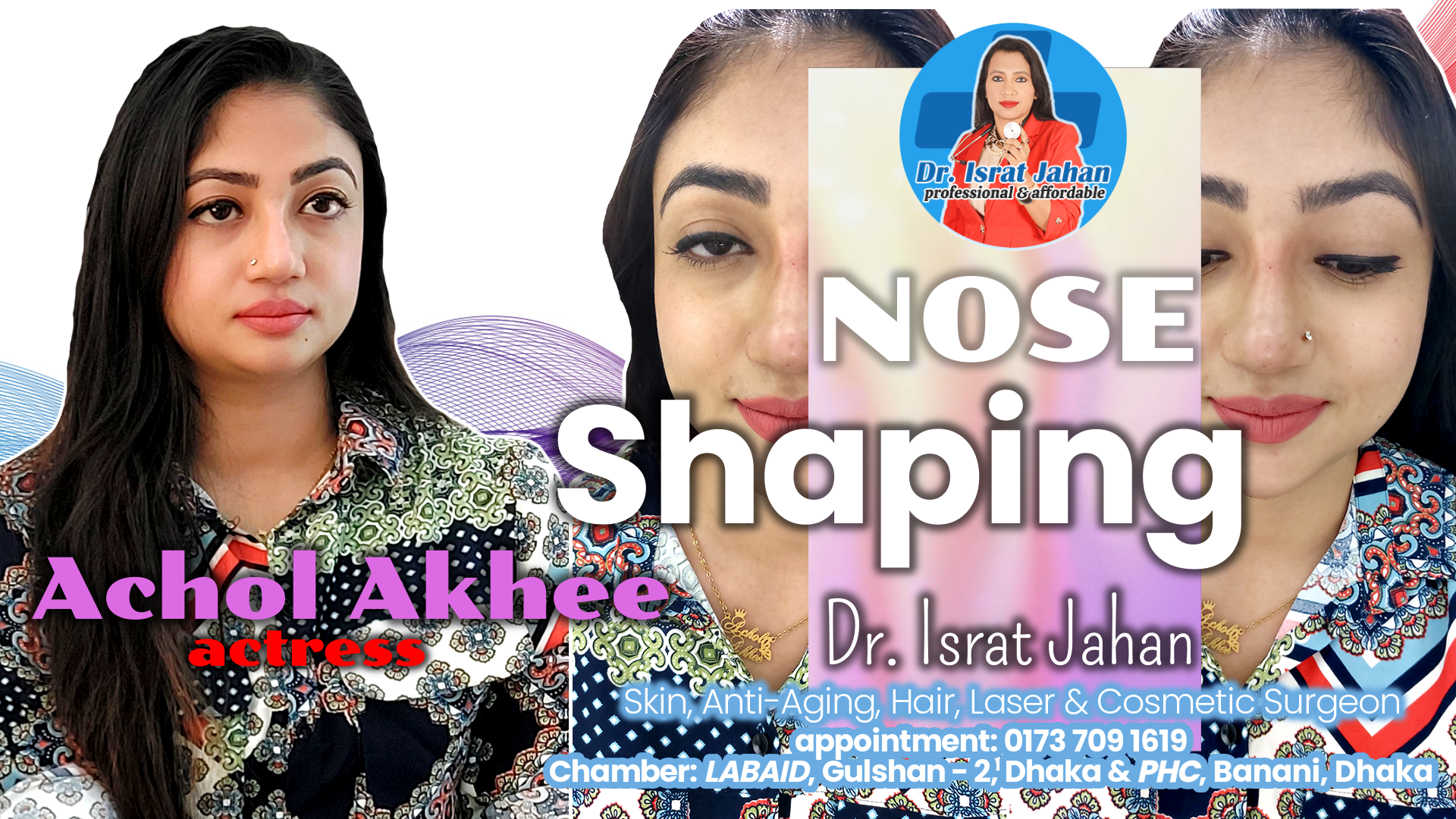 নাকের সৌন্দর্য বৃদ্ধিতে ফিলার এবং থ্রেড লিফট - নায়িকা আচল - ডাঃ ইসরাত জাহান