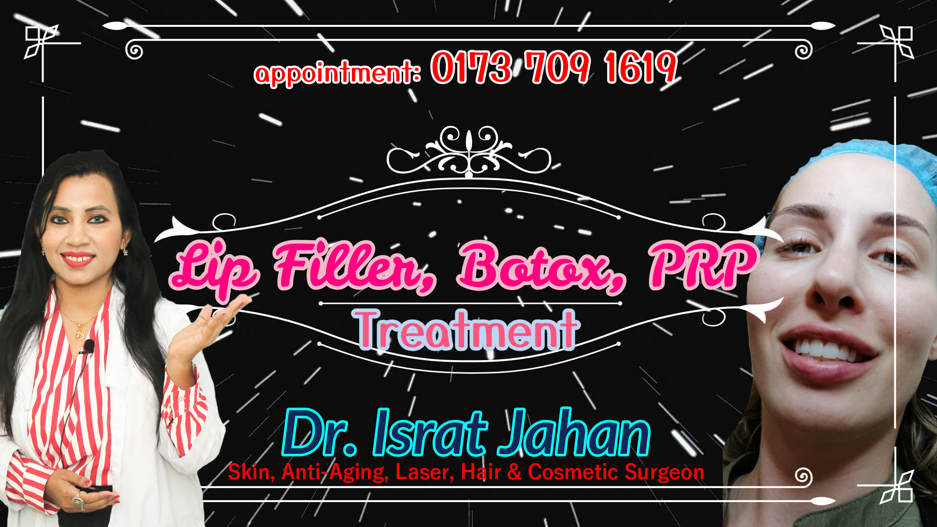 বোটক্স, ফিলার, পিআরপি - Lip Filler Botox PRP Treatment - Dr. Israt Jahan 