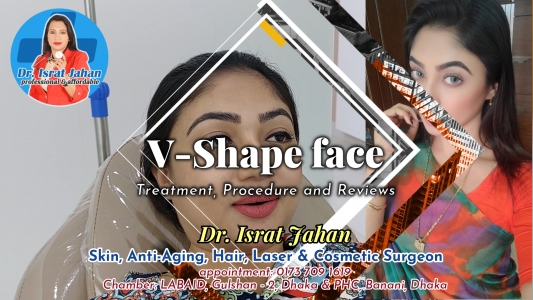 Achol Akhee V-Shape Treatment Procedure Reviews with chin filler Botox, threadlift - Dr. Israt Jahan