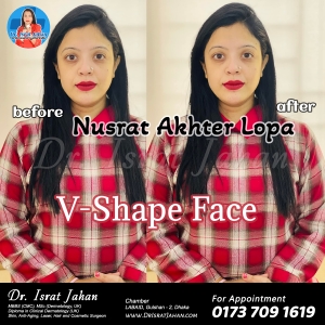 Treatment Nusrat Lopa Hur Nusrat V-shaped face filler botox threadlift