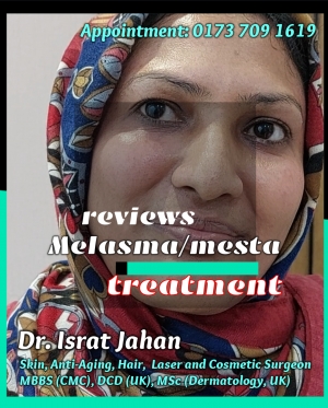 Reviews Mesta Melasma - Dr. Israt Jahan