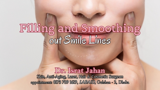 নেসোলেবিয়াল ফোল্ড অথবা লাফলাইন - Nasolabial folds - Dr. Israt Jahan